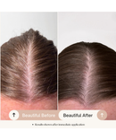 Healthy Scalp & Fullness Serum-5