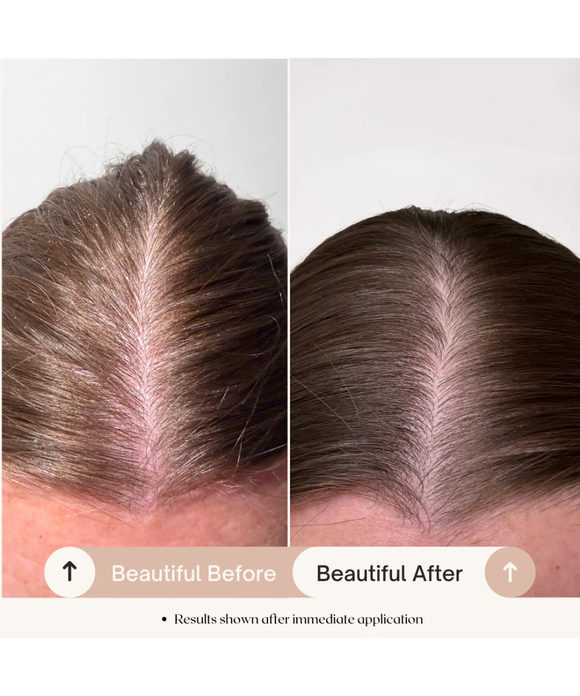 Healthy Scalp & Fullness Serum