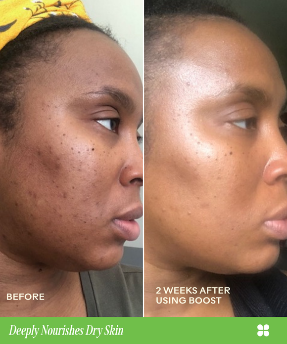Boost 49% Rosehip Oil Serum