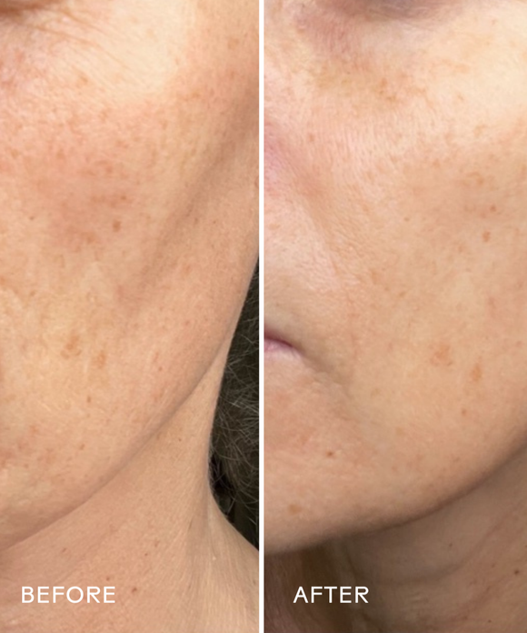 Boost 49% Rosehip Oil Serum