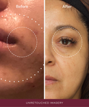 Adaptogenic Brightening Mask - Turmeric & AHA-4