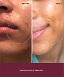 Golden Milk Cleanser-5