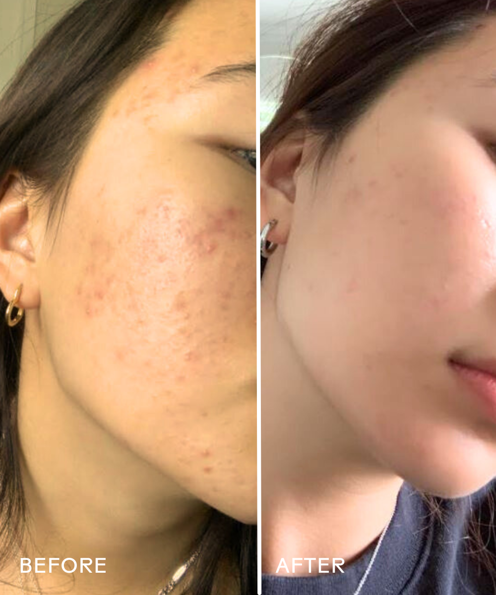Purify Aloe + Amino Acid Gel Cleanser