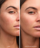 A side-by-side before and after comparison of a woman's face, showing skin texture and freckling improvement after 4 weeks of use. The left side is labeled 'BEFORE' and the right side reads '4 WEEKS AFTER USING UNDER CONTROL'.