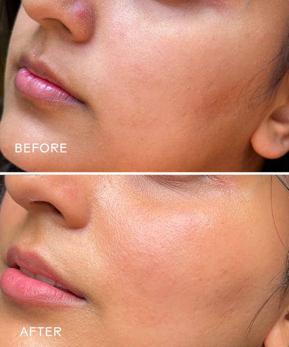 Harmony Cucumber + Kombucha Microbiome Milky Cleanser