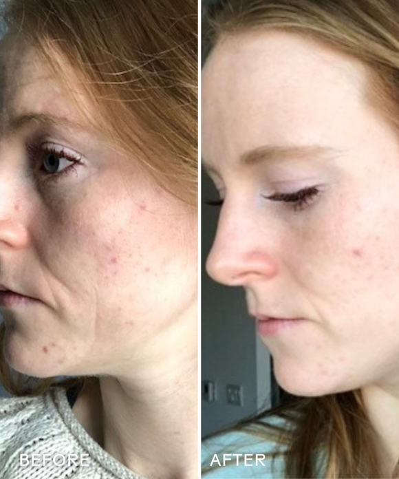 Refresh Papaya + Salicylic Acid Foaming Cleanser