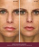 Radiance Ritual Set-6