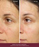 Radiance Ritual Set-5