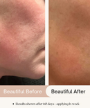 7.6% AHA Leave On Exfoliant-4