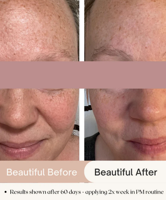 7.6% AHA Leave On Exfoliant