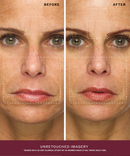 Radiance Face Serum-3