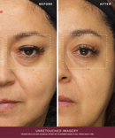 Radiance Face Serum-6