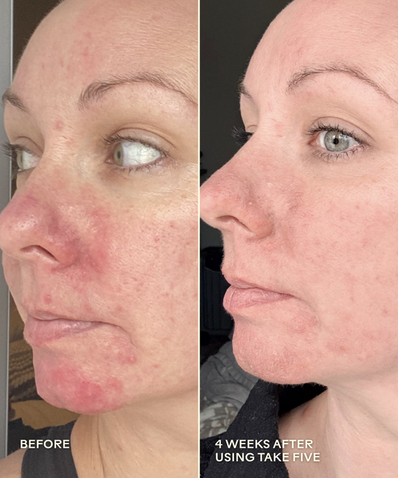 Take Five™ Hypochlorous Acid Balancing Body + Face Spray