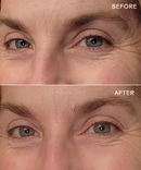 EyeHero™ Bio-Retinol Smoothing Eye Cream-6