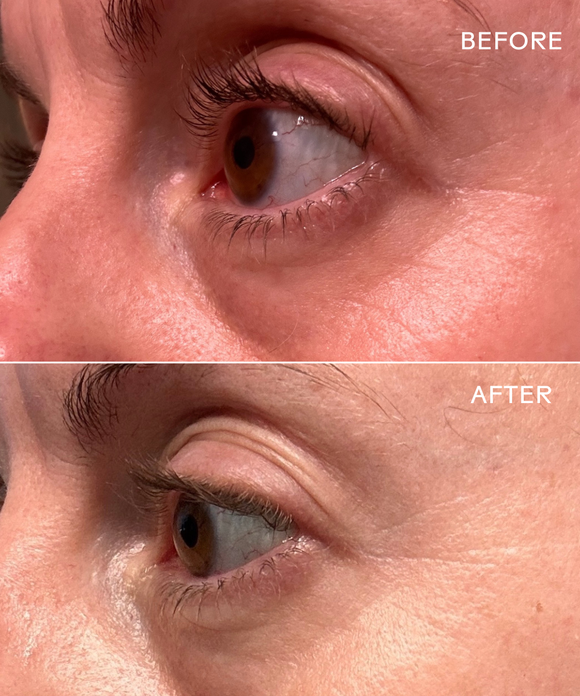 EyeHero™ Bio-Retinol Smoothing Eye Cream