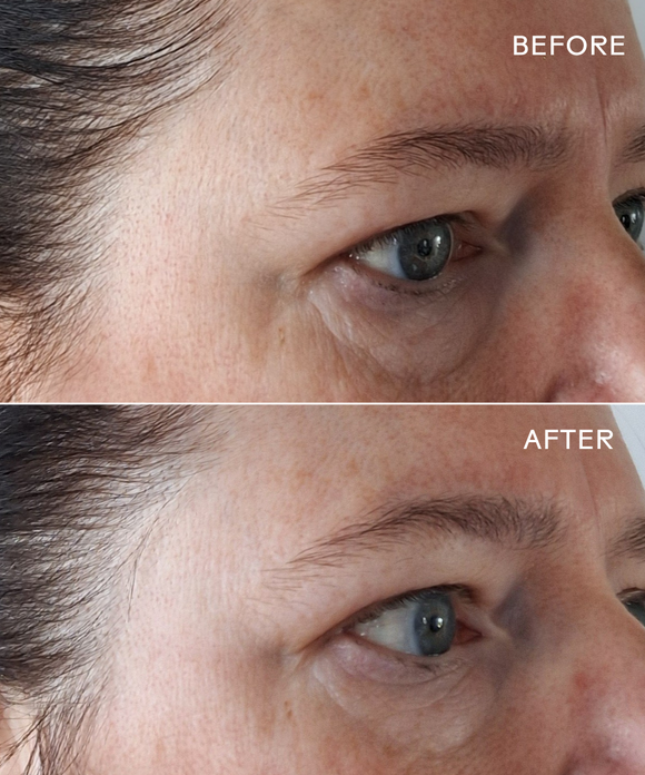 EyeHero™ Bio-Retinol Smoothing Eye Cream