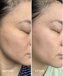 Radiance Grape Stem Cell + Squalane Ultra-Hydrating Cream-5