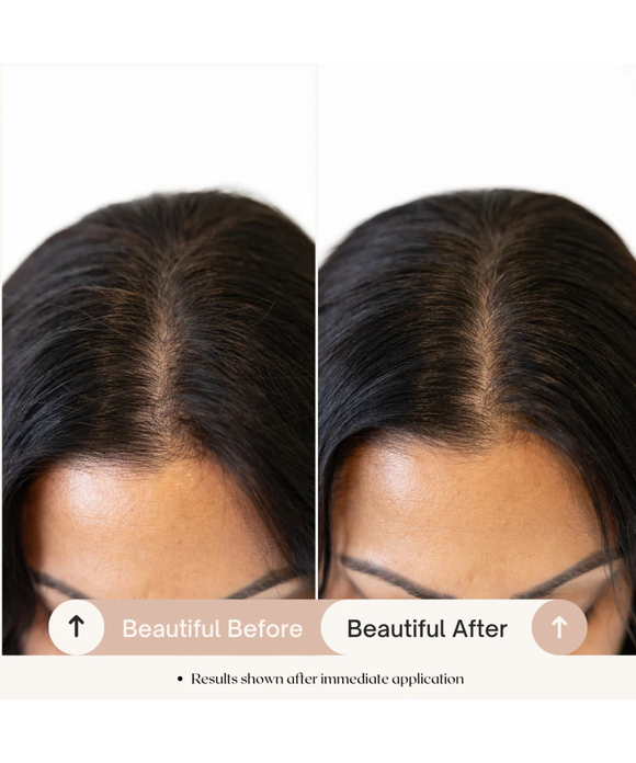 Healthy Scalp & Fullness Serum