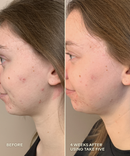 Take Five™ Hypochlorous Acid Balancing Body + Face Spray-9