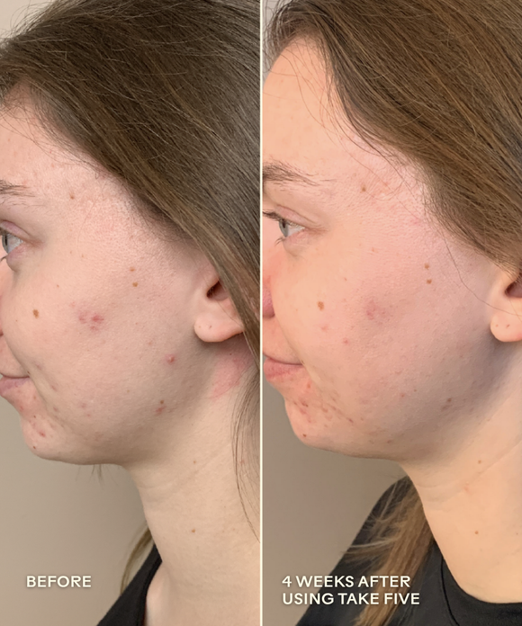Take Five™ Hypochlorous Acid Balancing Body + Face Spray