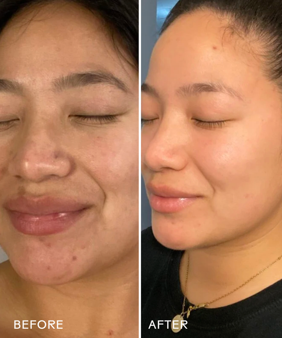 Dream Bio-Retinol + Shorea Butter Rejuvenating Cream