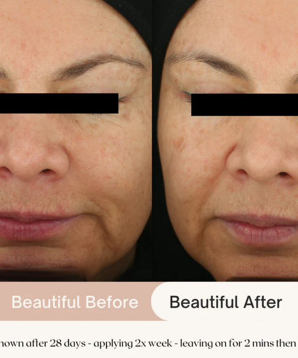 7.6% AHA Leave On Exfoliant