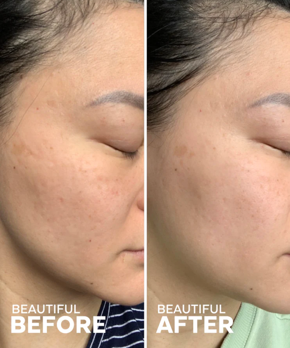 Dew Drops Mushroom + Kakadu Plum Hyaluronic Acid Serum