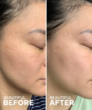 Jelly Drops Kakadu Plum + Mushroom Hyaluronic Acid Serum-6