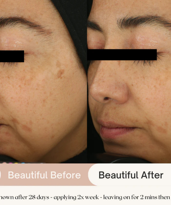 7.6% AHA Leave On Exfoliant
