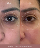 Golden Glow Eye Balm-3