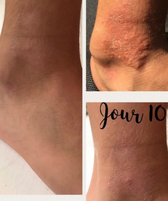 Corpa Cera - Lipid-Replenishing Soothing Liquid Balm