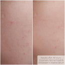 Bright Daily Serum - Vitamin C, Ferulic Acid & Hyaluronic Acid - AK Dermal - Portia-Ella