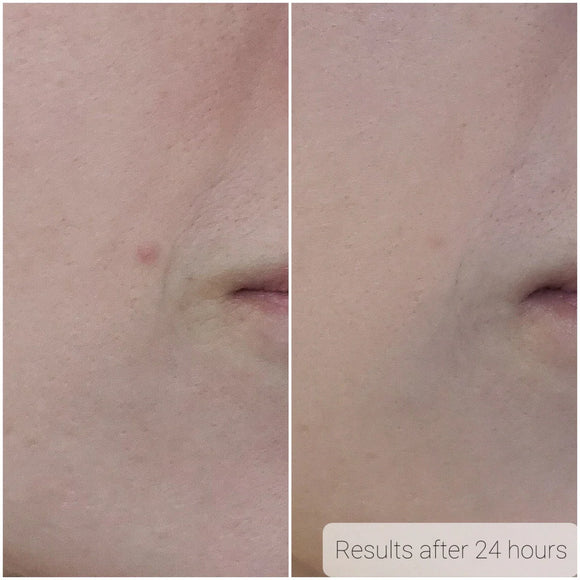 Enzymatic Dermal Polish - AK Dermal - Portia-Ella