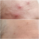 Enzymatic Dermal Polish - AK Dermal - Portia-Ella