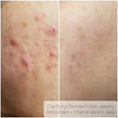 Bright Daily Serum - Vitamin C, Ferulic Acid & Hyaluronic Acid - AK Dermal - Portia-Ella