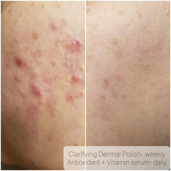 Bright Daily Serum - Vitamin C, Ferulic Acid & Hyaluronic Acid - AK Dermal - Portia-Ella