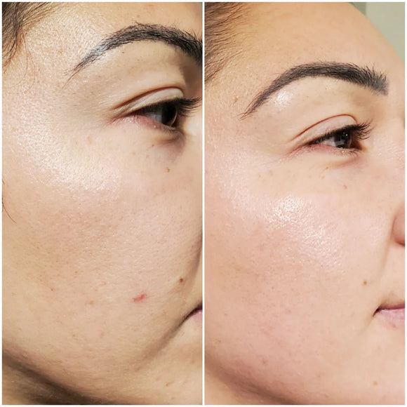 Bright Daily Serum - Vitamin C, Ferulic Acid & Hyaluronic Acid - AK Dermal - Portia-Ella